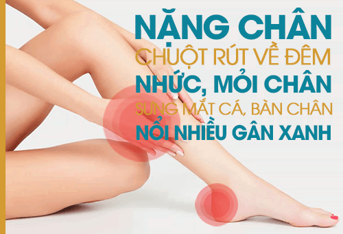 dau hieu gian tinh mach