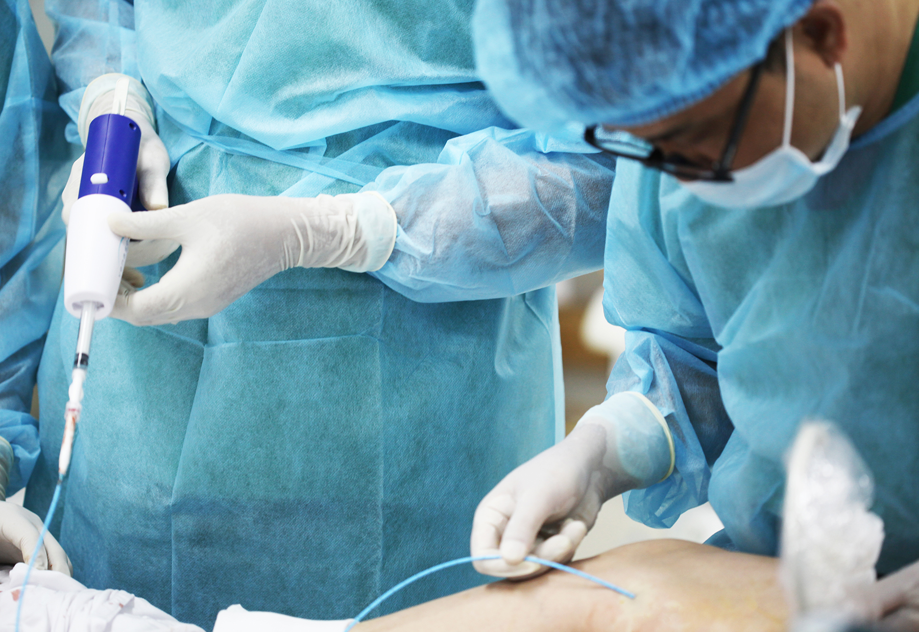 ứng-dụng-keo-sinh-học-trong-điều-trị-giãn-tĩnh-mạch (13)