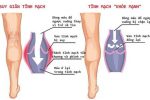 Một số nguyên nhân giãn tĩnh mạch chân